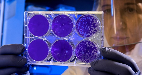 The Artificial Neural Network Found That Antibiotics Kill