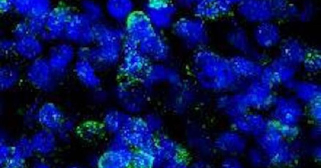 The Human Brain's Small Biological Model Reveals the Effects of Hallucinations