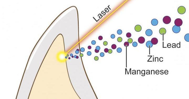 The Link Between Autism and Toxic Lead Levels Found in Young Teeth