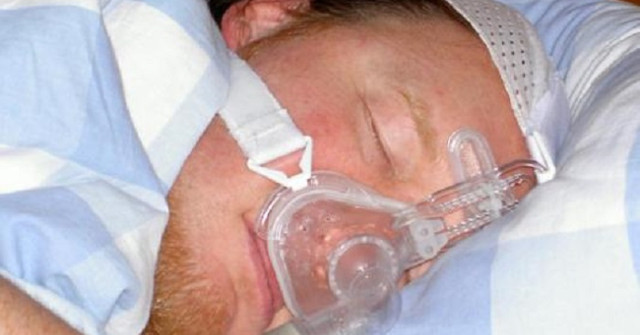 The United States Announced the Implant Device to Overcome Sleep