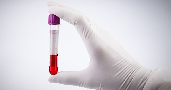 The US FDA Allows Transfusion of Cured Human Plasma to Treat