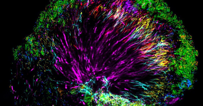 The World of Microbes Shimmering and Fantasy on Your Teeth