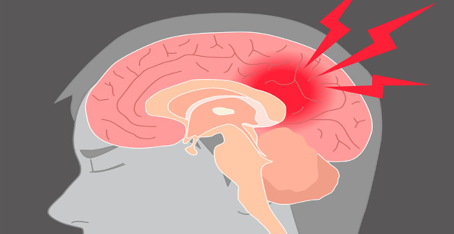 This Is What Happens to the Brain When You Are Hit on the Head