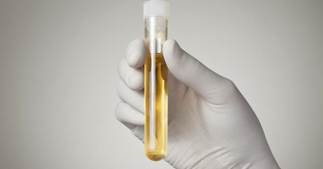 To Know Your Biological Age, Check Your Urine Sample