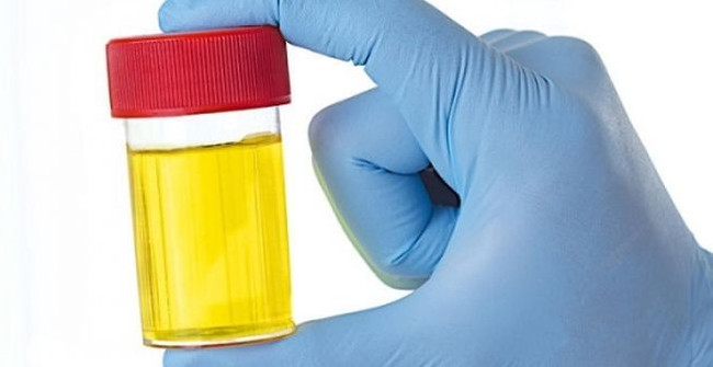 Urine and 10 Wonderful Uses to Save All Humanity Surprise You