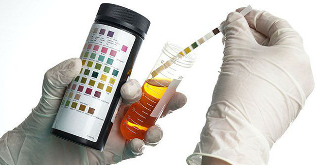 Urine Testing Can Detect Mad Cow Disease