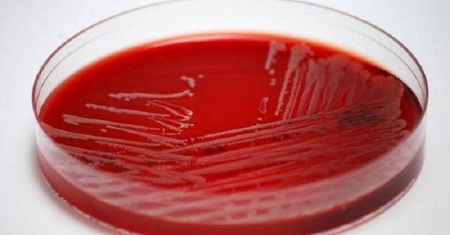 Using Statins Can Reduce the Risk of Dangerous Blood Infections