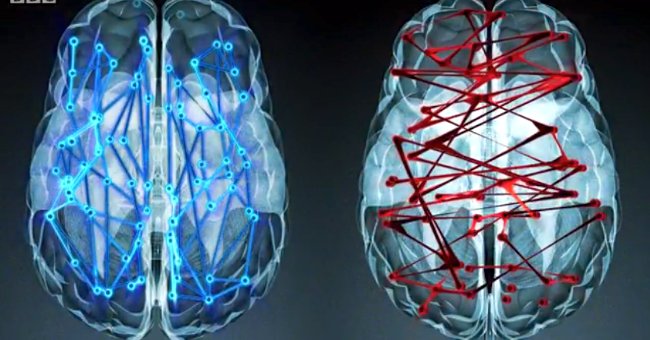 What Is the Difference Between the Brain of Men and Women