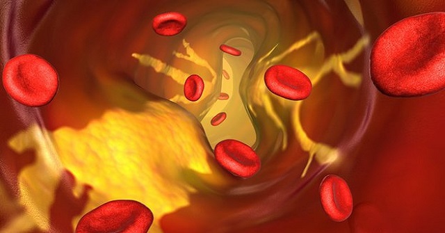 What Is Triglyceride? What Is the Normal Triglyceride Index?