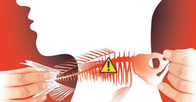 What to Do When Having a Fishbone Bump: Fish Bone Healing Tips