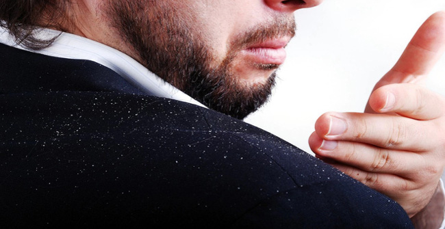 Why Do Dandruff Come All the Way to Winter Even if You Still Wash