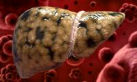 10 very good foods for the liver that you should not ignore