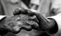 6 strange facts about leprosy you may not know yet