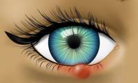 8 signs of abnormal eye warning about your health