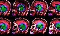 A total of more than 100 human memory-related genes have been identified