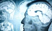 Alzheimer's can help treat patients with brain injury