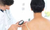 Artificial intelligence can help detect melanoma skin cancer