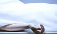 Close-up of the transformation of the human body after death