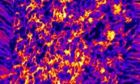 Finding new ways to study cholesterol distribution on cells
