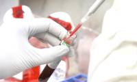 For the first time scientists have compiled the immune map of Covid-19 patients