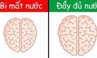 How does daily activities affect the brain?