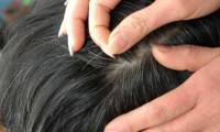 Immeasurable harm from plucking silver hair