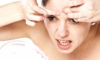 It turns out that many acne sufferers will get older