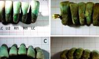 Italian archeology finds the oldest set of dentures in the world