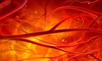 Manufacturing artificial blood vessels to limit surgery 7 times for children with heart defects