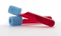 Medical breakthrough: Find a method to diagnose cancer before getting sick