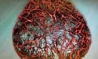 Scientists successfully cultivate the perfect human vascular system in the laboratory