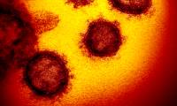 Taking Covid-19 virus image at atomic resolution, scientists discovered its chemical infectious nature