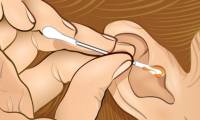 The color of earwax helps you identify your health status