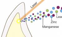 The link between autism and toxic lead levels found in young teeth