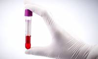 The US FDA allows transfusion of cured human plasma to treat serious cases of Covid-19 but is prohibited for use in healthy individuals