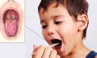 Things to know about diphtheria