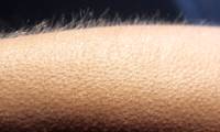 This is the only part of the body that never 'goosebumps'.