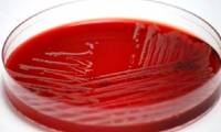 Using statins can reduce the risk of dangerous blood infections