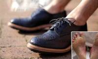 Wearing shoes without wearing socks contains more dangerous consequences than you think