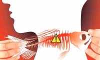 What to do when having a fishbone bump