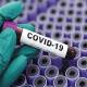 Photo of Covid-19 is unlike seasonal flu, it is dozens of times more dangerous