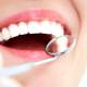 Photo of Porcelain crowns finished care and hygiene properly?