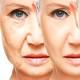Photo of Without surgery, this is an effective way to stretch your face