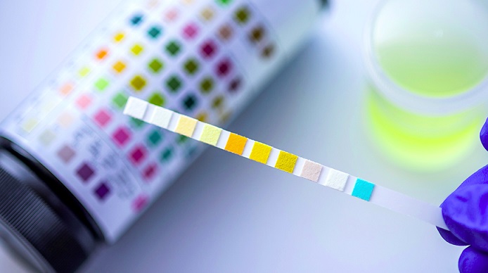 Picture 1 of 4 Qualities That You Want in Drug Testing Services For Employers in Farmington Hills MI