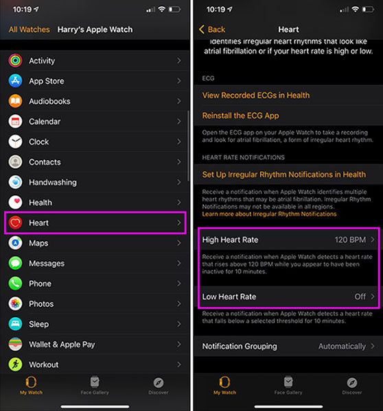 What health conditions can the Apple Watch recognize? Picture 2