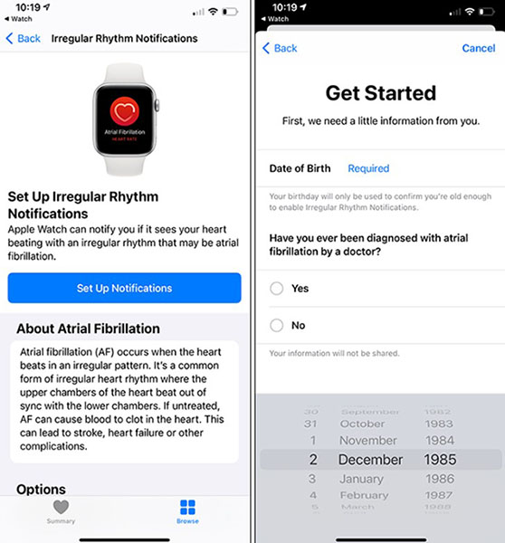What health conditions can the Apple Watch recognize? Picture 4