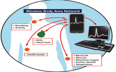 What is WBAN (Wireless Body Area Network)? Picture 1