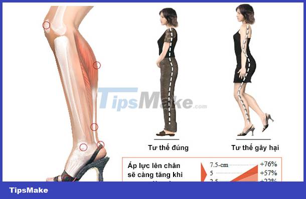 Be careful when wearing high heels Picture 2