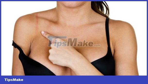 If you have back pain, you should review your bra Picture 2