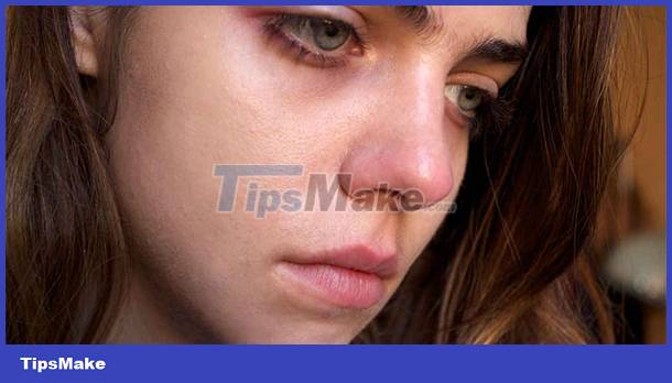 Look at the face and guess the disease Picture 1